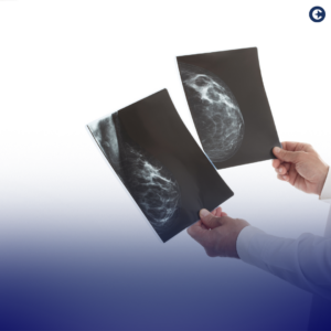 Recognizing Mammography Day on October 20th: Understand the importance of mammograms in early breast cancer detection, debunk common myths, and prioritize women's health. Early detection can save lives.