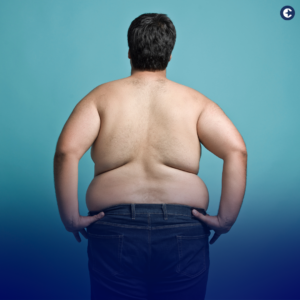 Explore the significance of National Obesity Awareness Day in our latest blog. Learn about obesity, its impact on health, and treatment options like Ozempic. Understand how health insurance can cover these treatments and discover ways to manage obesity effectively. Join us in raising awareness and promoting healthy lifestyles.